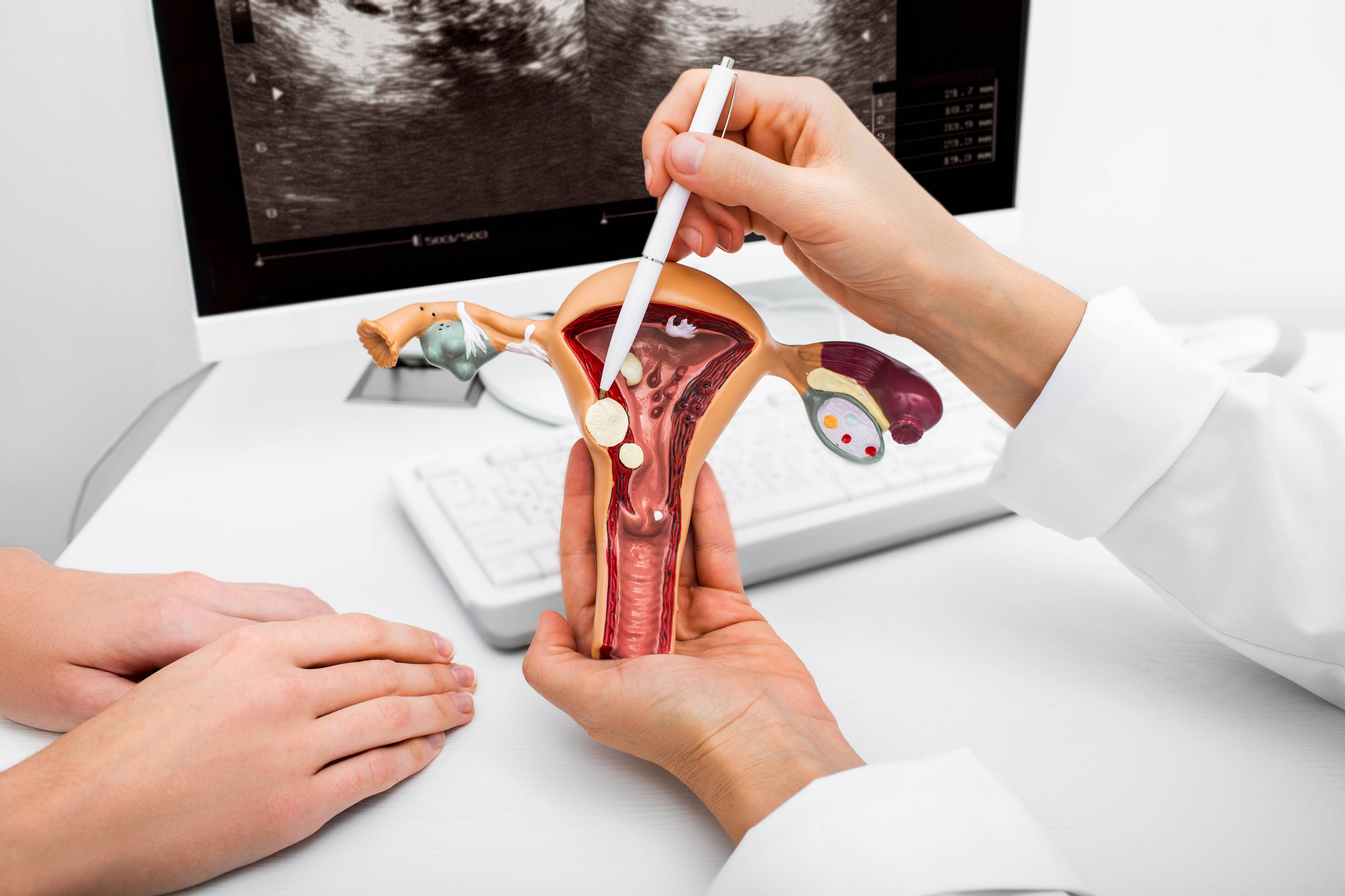 Co řeší všeobecná gynekologická chirurgie?