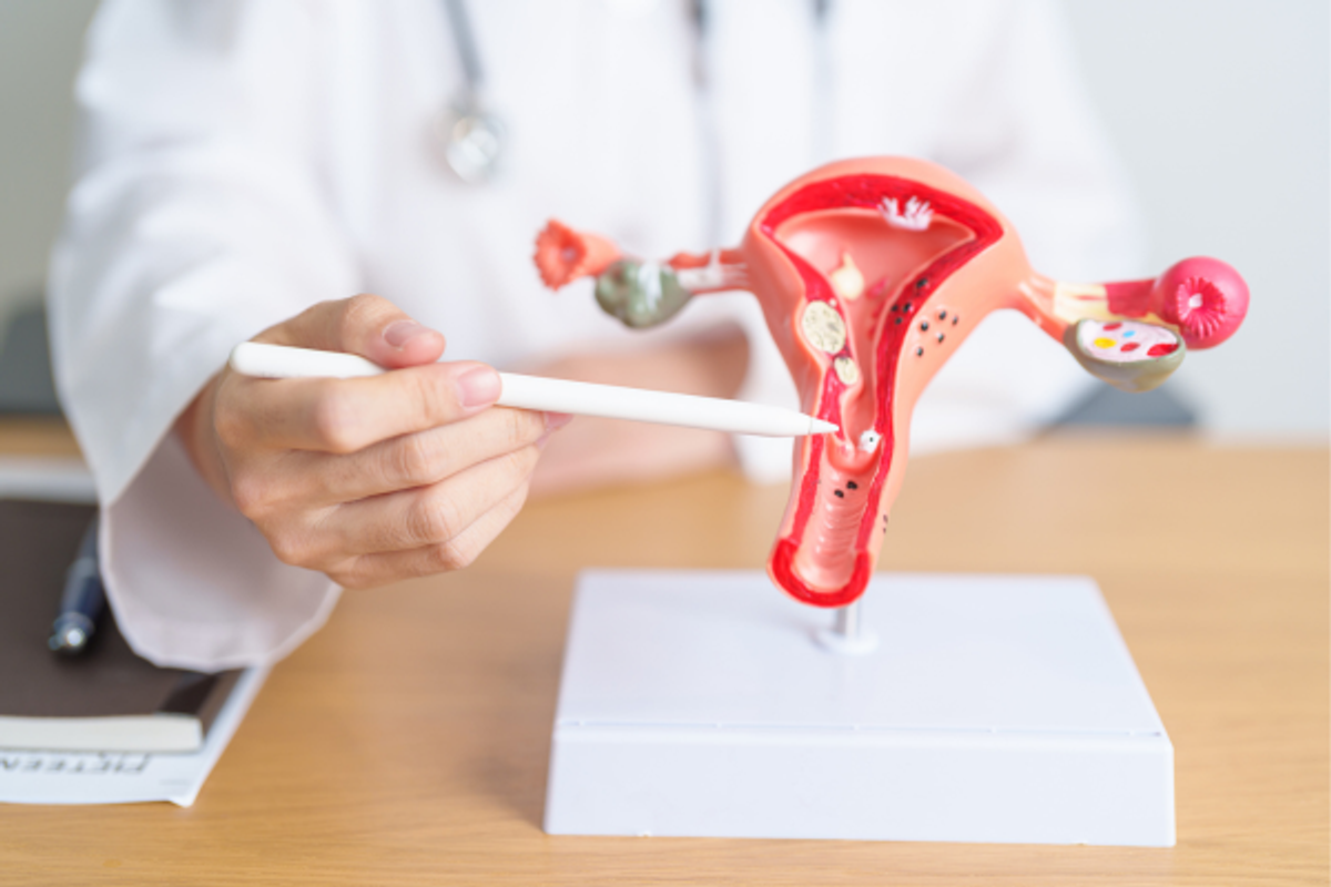 iscare, gynekologie, hpv, onemocneni, delozni cipek