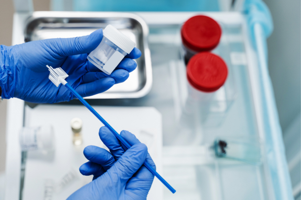 iscare, gynekologie, pap test, hpv test