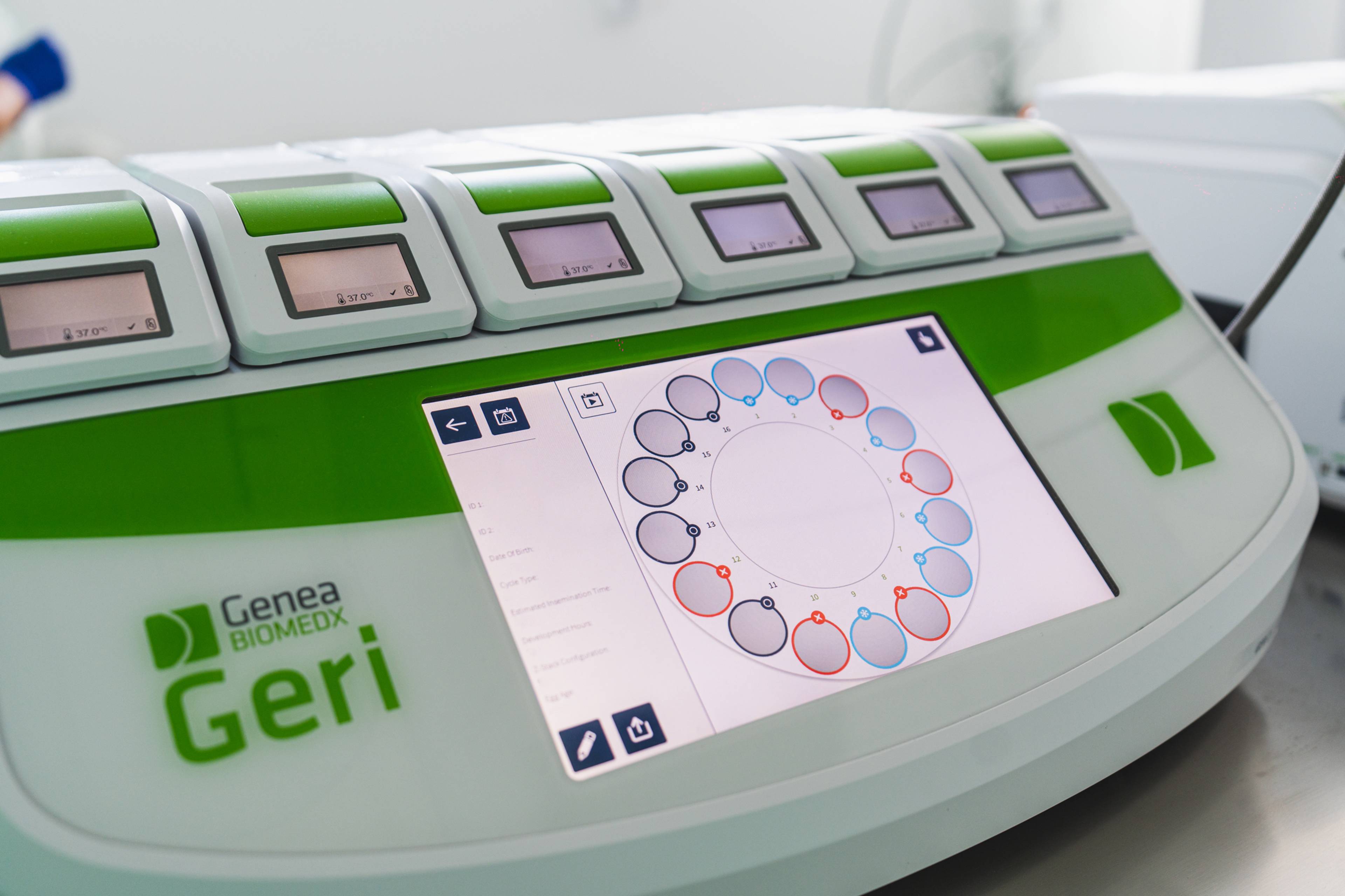 Embryo monitoring time-lapse GERI.