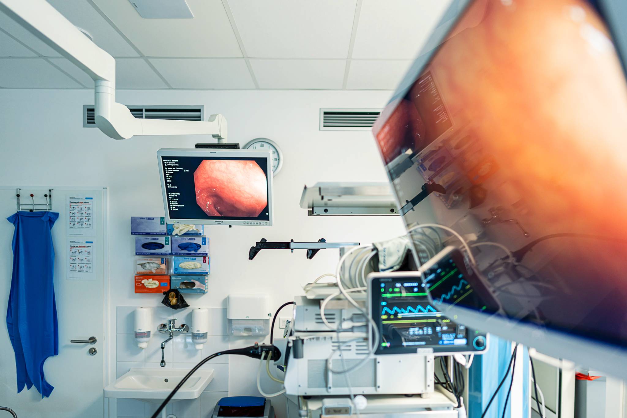 Potom Ultrasonografie břicha a střev | ISCARE
