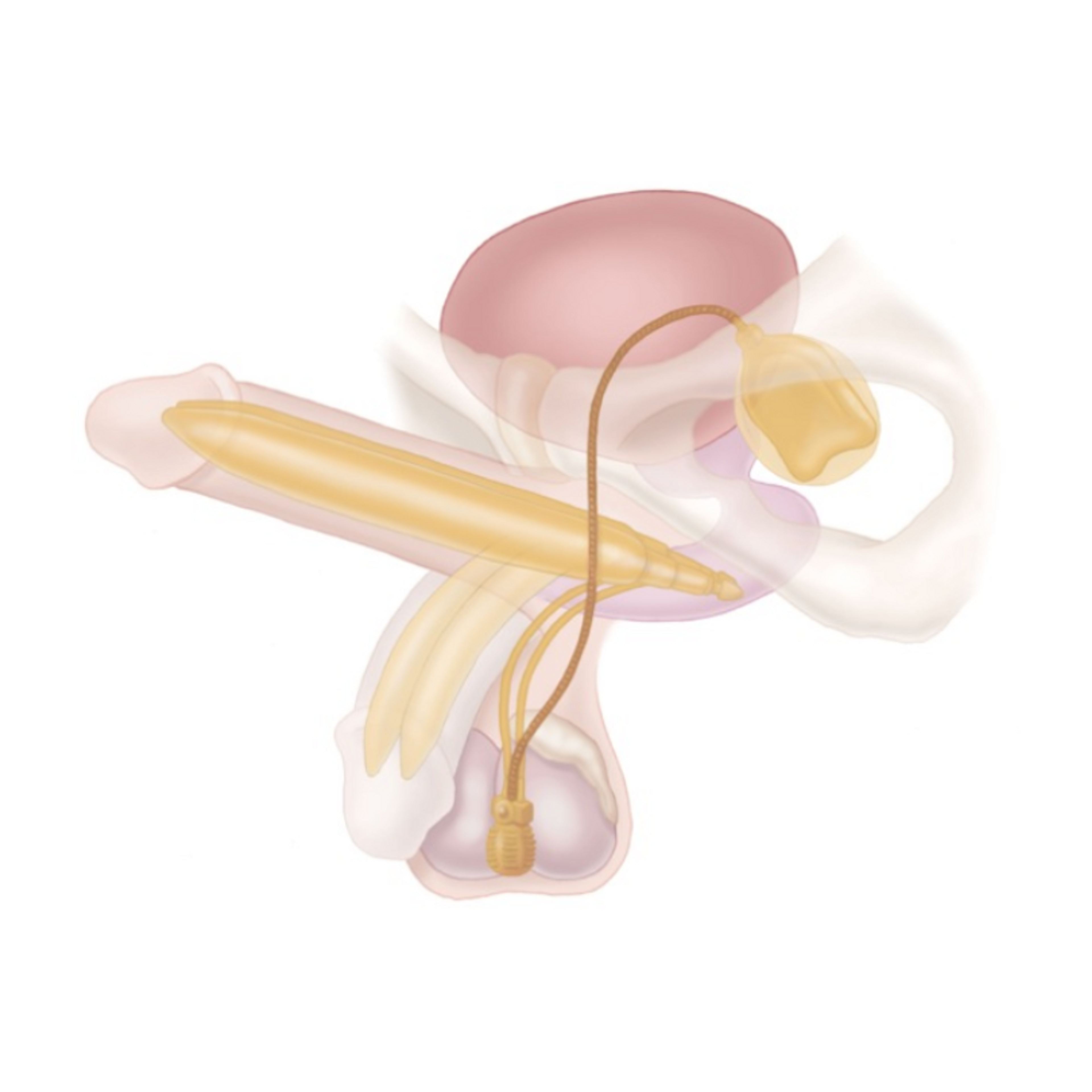 Nafukovací penilní implantáty 