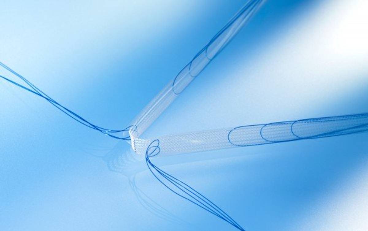 ISCARE, gynekologie, léčba stresové inkontinence pomocí pásky ISCARE, gynekologie, léčba stresové inkontinence pomocí pásky