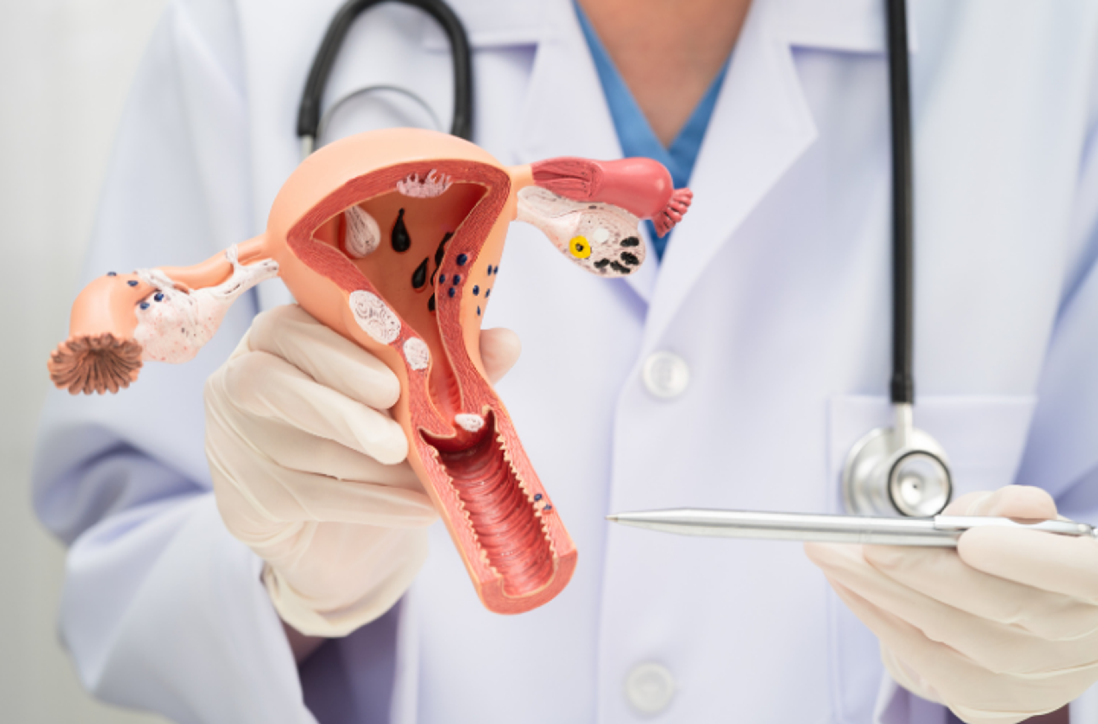 Adnexální chirurgie 