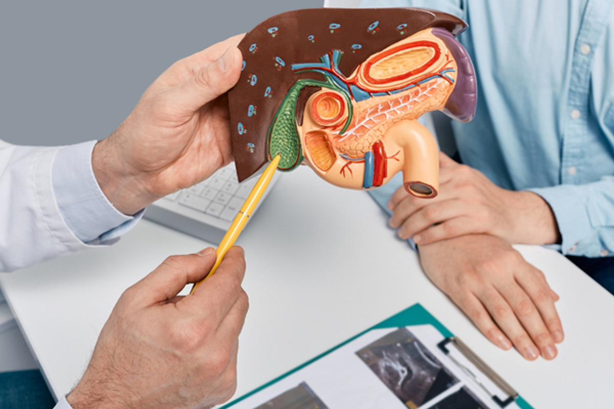 zlucnikove kameny, diagnostika, konzultace, operace zlucniku, klinika iscare