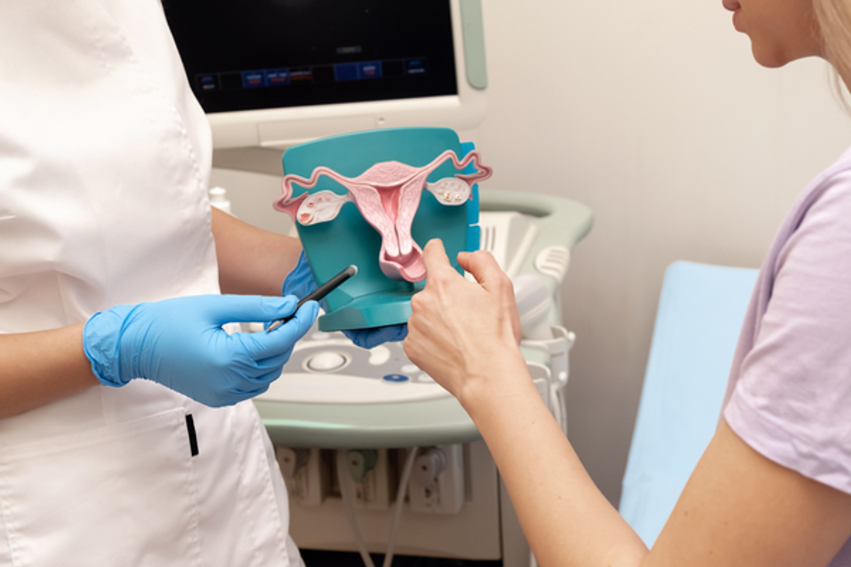 endometrioza, diagnostika, lecba, gynekologie, iscare